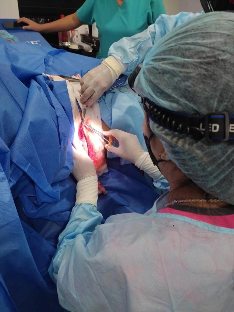 Labioplastía Estética Funcional con Láser CO2 6 La Dra. Chiang en plena intervencion de Labioplastia con Laser CO2