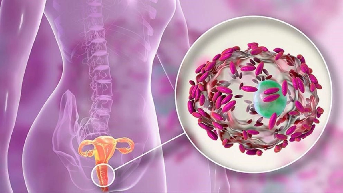 Secreción Vaginal con mal olor ¿La has padecido alguna vez? 4 Secrecion Vaginal con mal olor