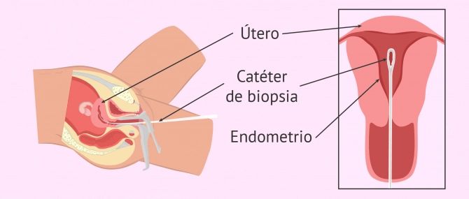 Pruebas de Fertilidad en la mujer ¿Cuáles son, como realizarlas y precios? 9 biopsis