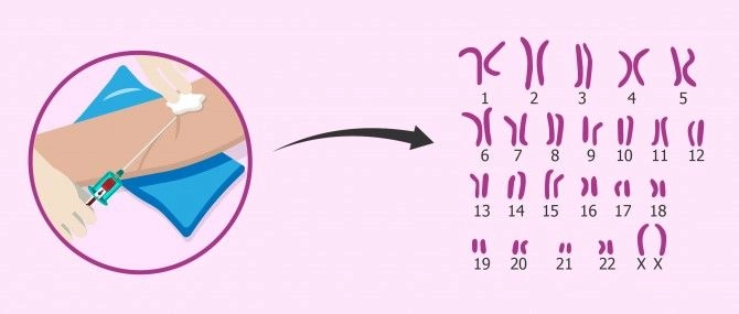 Pruebas de Fertilidad en la mujer ¿Cuáles son, como realizarlas y precios? 7 cromosomas