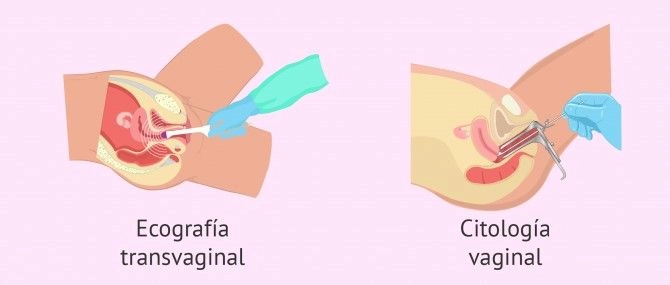 Pruebas de Fertilidad en la mujer ¿Cuáles son, como realizarlas y precios? 5 eco