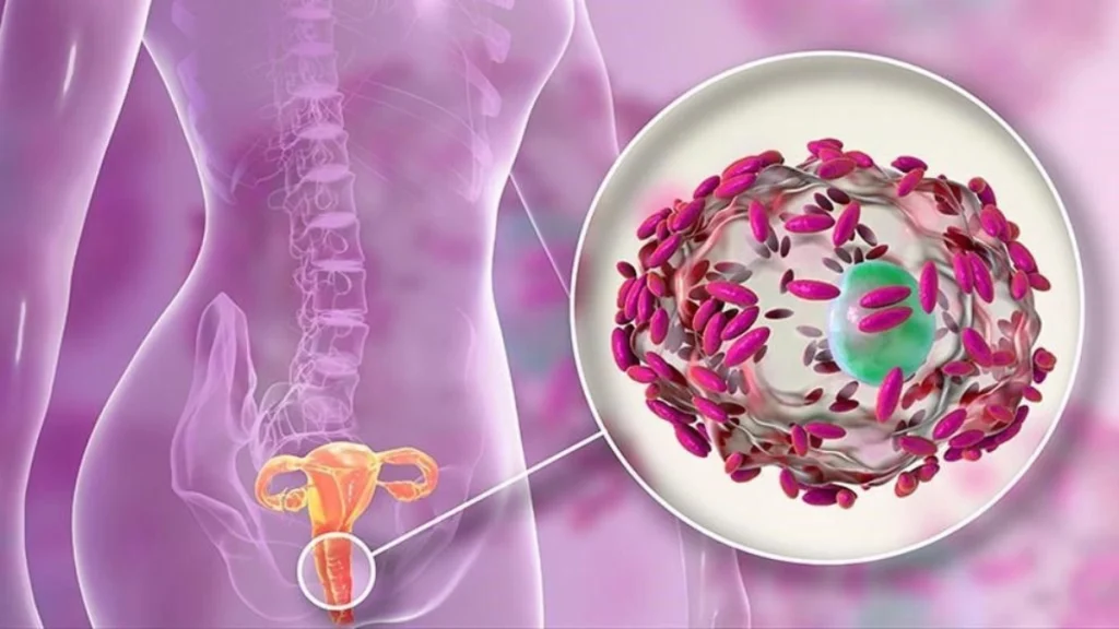 Secreción Vaginal con mal olor ¿La has padecido alguna vez?