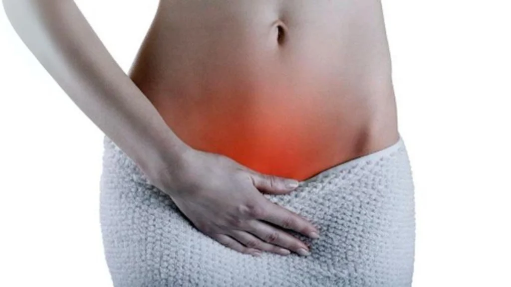 Vulvovaginitis alergica Tener picores no siempre significa infeccion