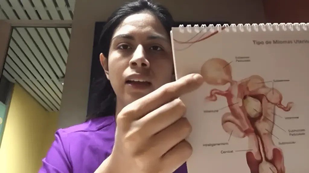 Miomas Uterinos: Todo lo que necesitas saber sobre los Miomas Uterinos
